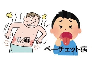 オテズラとインタラクションに関するよくある質問