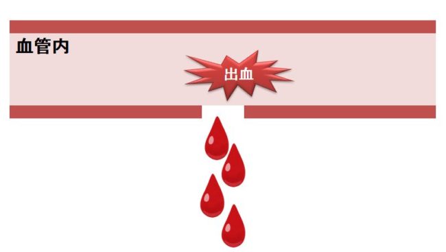 ヘムライブラの副作用