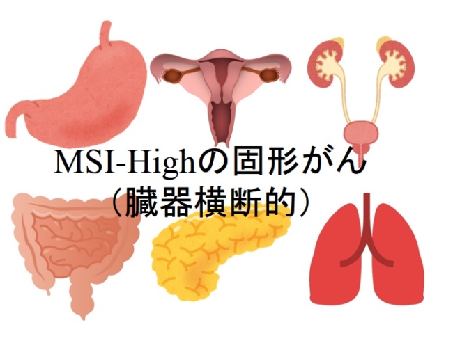 キイトルーダ vs. イフィンツィ
