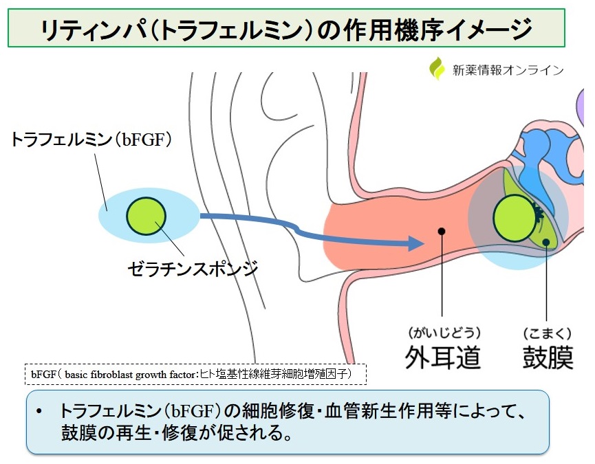 リティンパ耳科用（トラフェルミン）の作用機序：bFGFによる鼓膜再生・修復