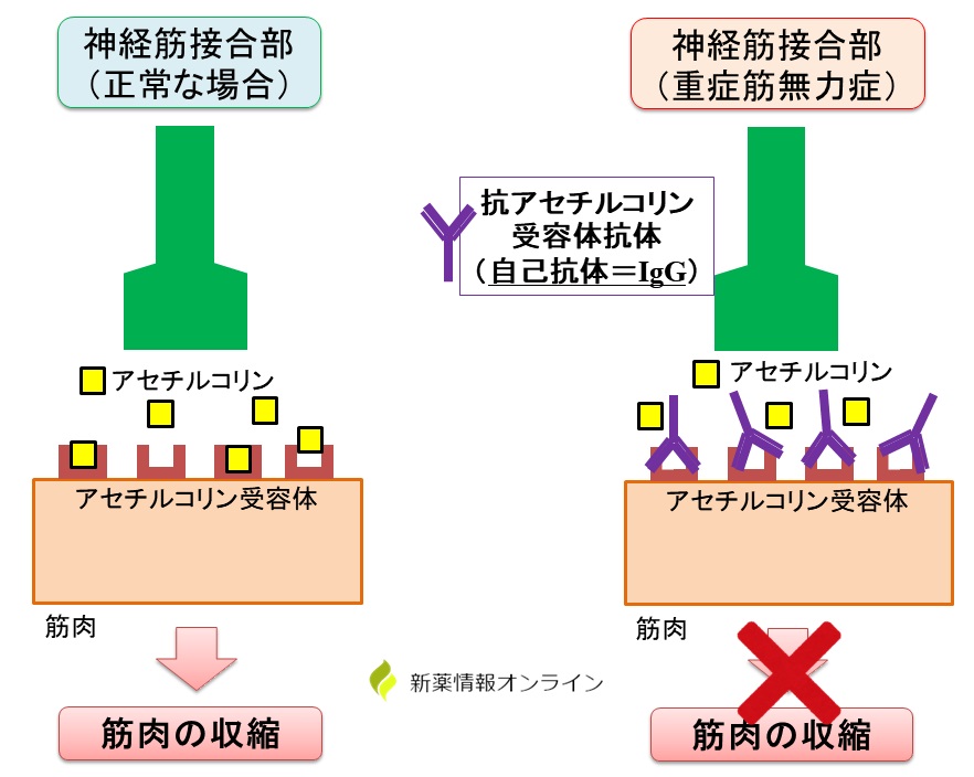 ウィフガート エフガルチギモド の作用機序 重症筋無力症 新薬情報オンライン