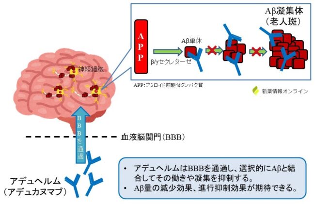 アデュヘルムと避妊