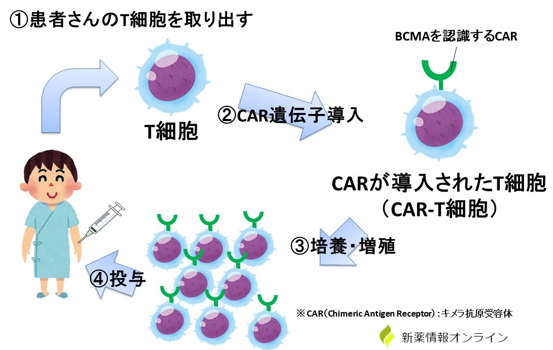 カービクティ（CAR-T療法）の概念・手順