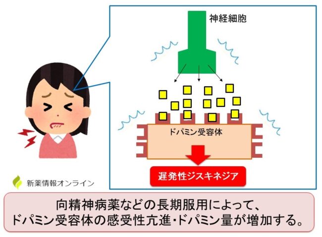 ゼナジンの代替品