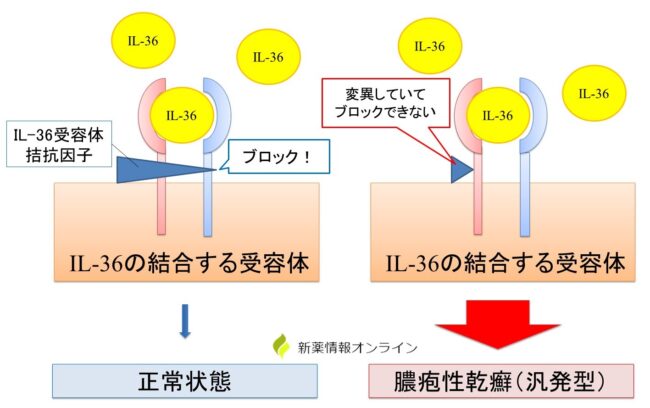 全身性膿疱性乾癬に対するSpevigoの使用