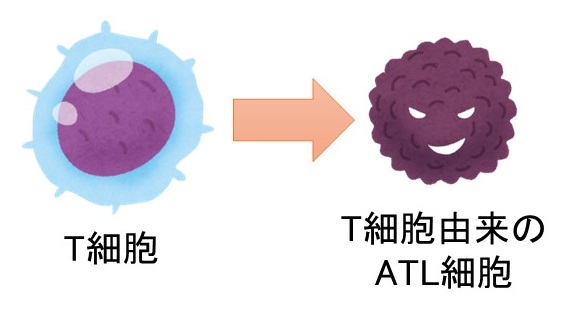 HTLV-1（ヒトT細胞白血病ウイルス1型）というウイルス感染によって引き起こされるT細胞腫瘍