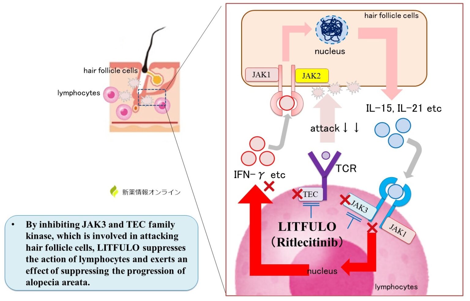 LITFULO（Ritlecitinib） mechanism of action【Severe Alopecia Areata】 - 新薬 ...