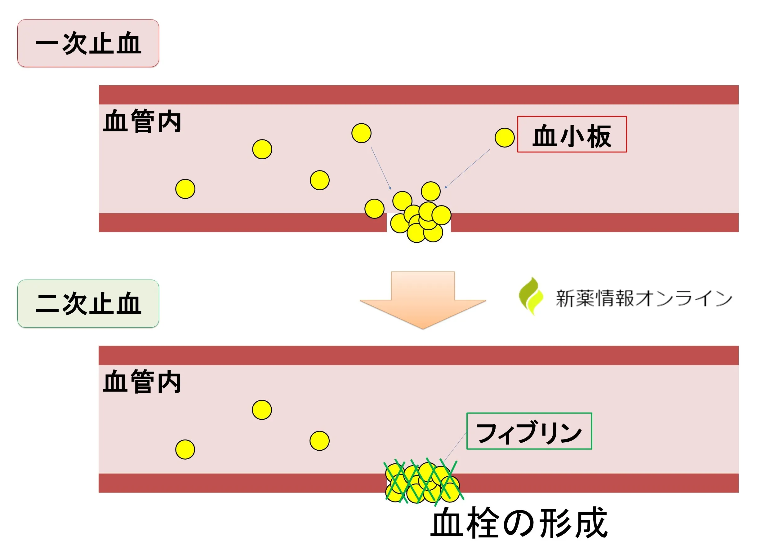 ヒムペブジ皮下注（マルスタシマブ）の作用機序・特徴【血友病】 - 新薬情報オンライン
