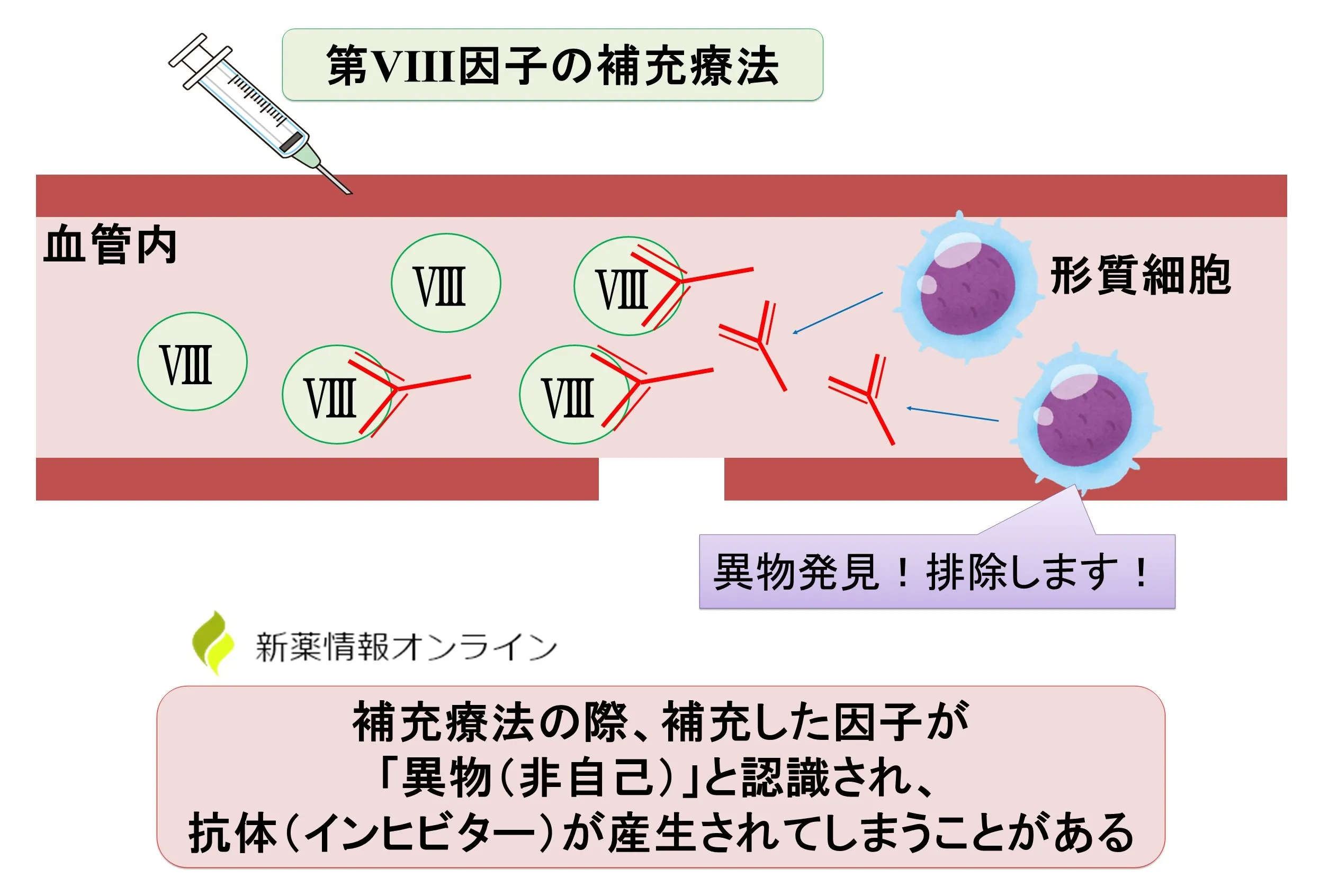 血友病の定期補充療法におけるインヒビターの出現