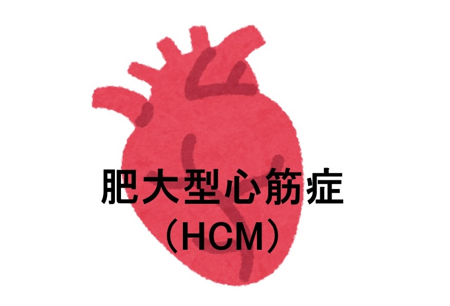 症例に学ぶ 肥大型心筋症 大型本（大型本） ファイル:肥大型心筋症.jpg - Wikipedia