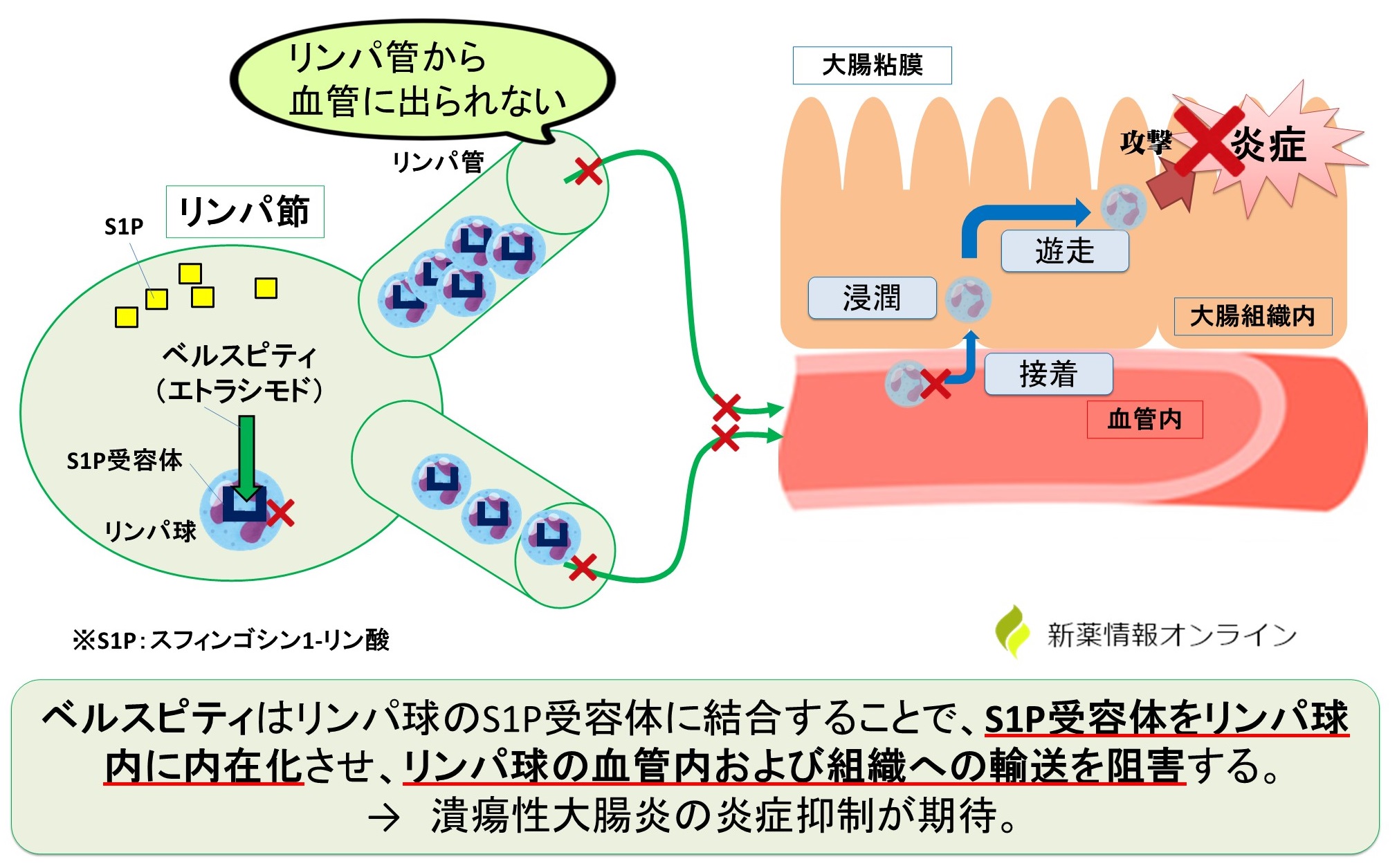 ベルスピティ（エトラシモド）の作用機序：S1P受容体調整