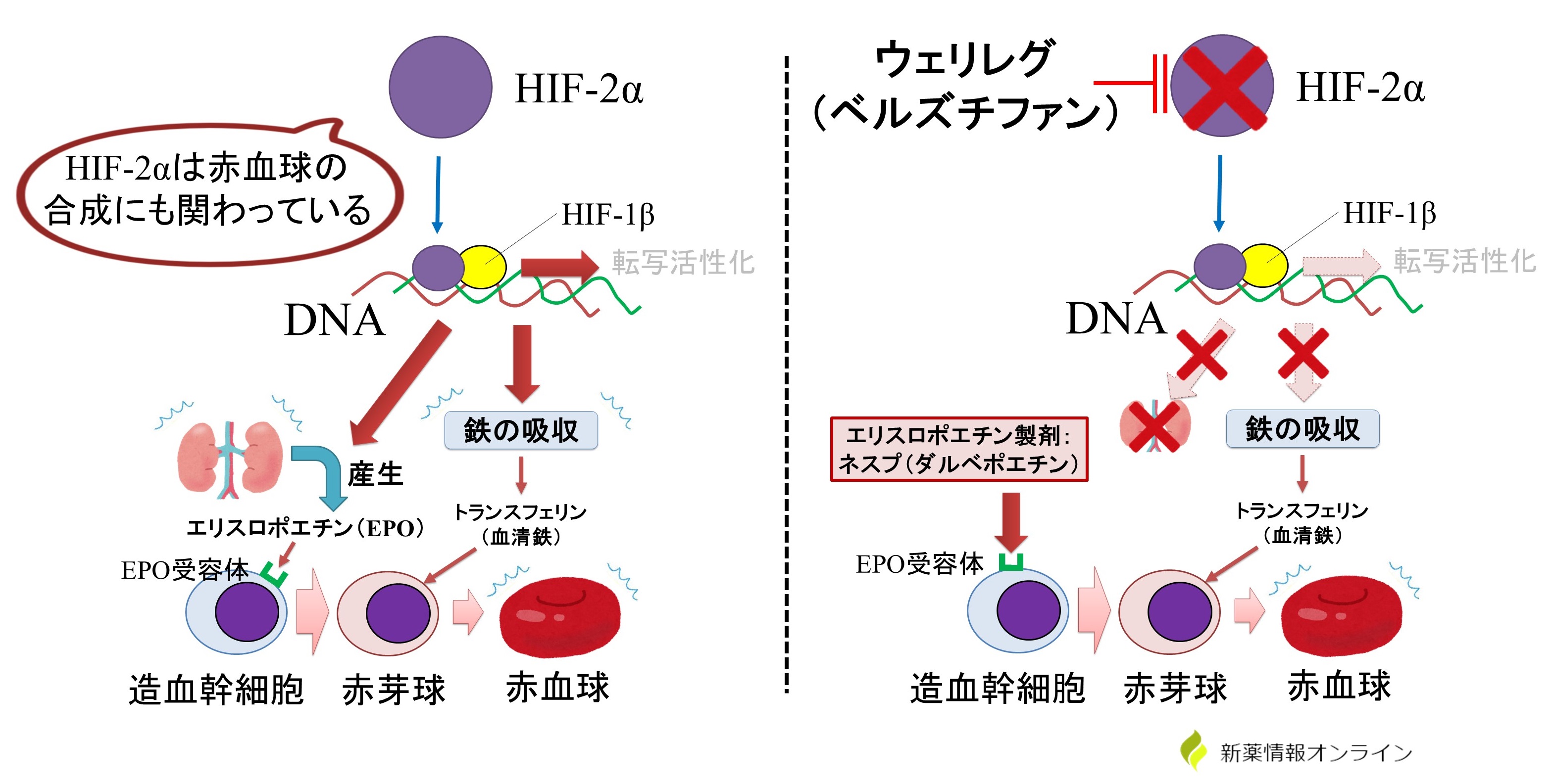 ウェリレグ（ベルズチファン）の副作用には腎性貧血がある。対策としてエリスロポエチン製剤のネスプ（ダルベポエチン）を使用する。