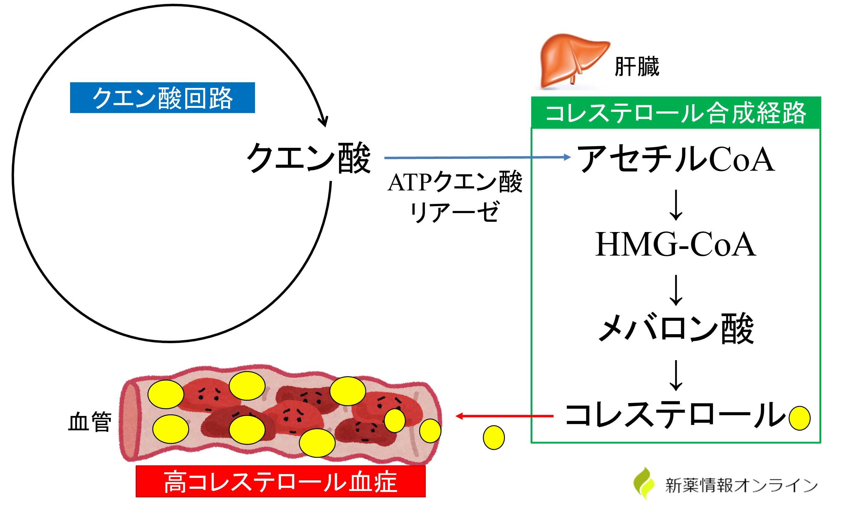 コレステロール合成経路におけるATPクエン酸リアーゼ
