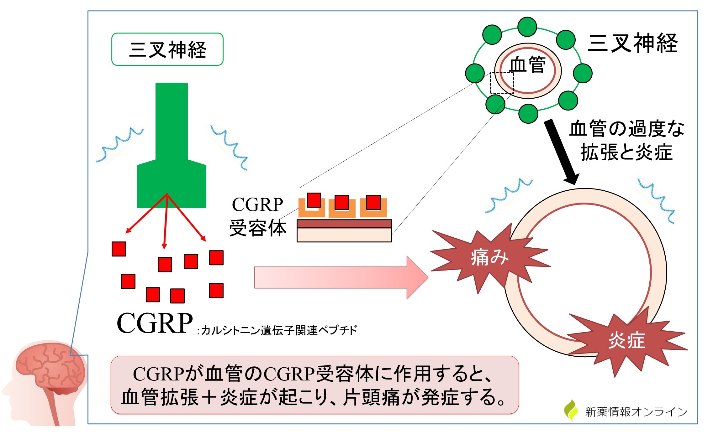 片頭痛の発症と三叉神経血管説：CGRPが関与している