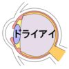 ドライアイ