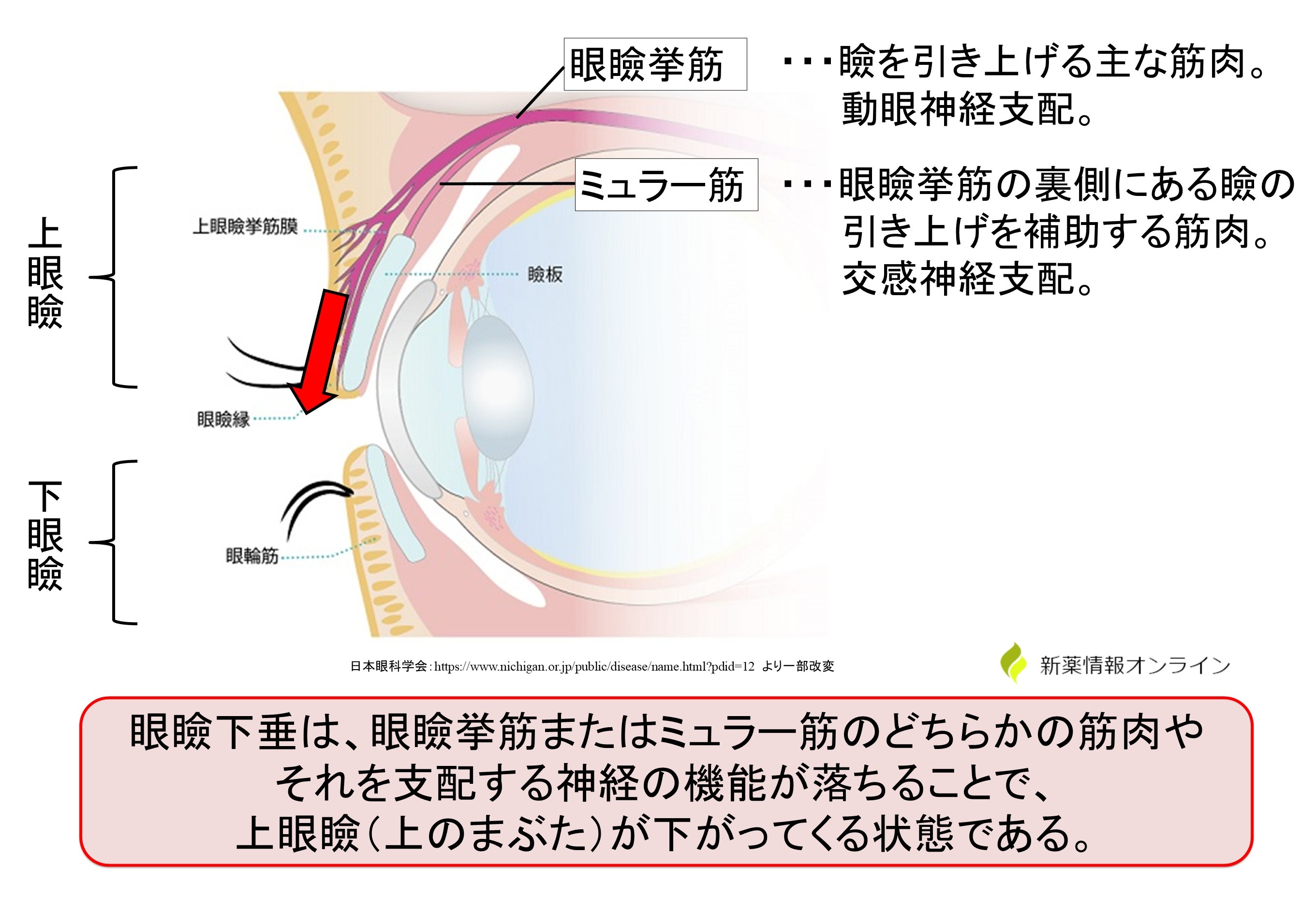 眼瞼下垂とミュラー筋の関係図：眼瞼挙筋やミュラー筋の機能や支配する神経の機能低下による