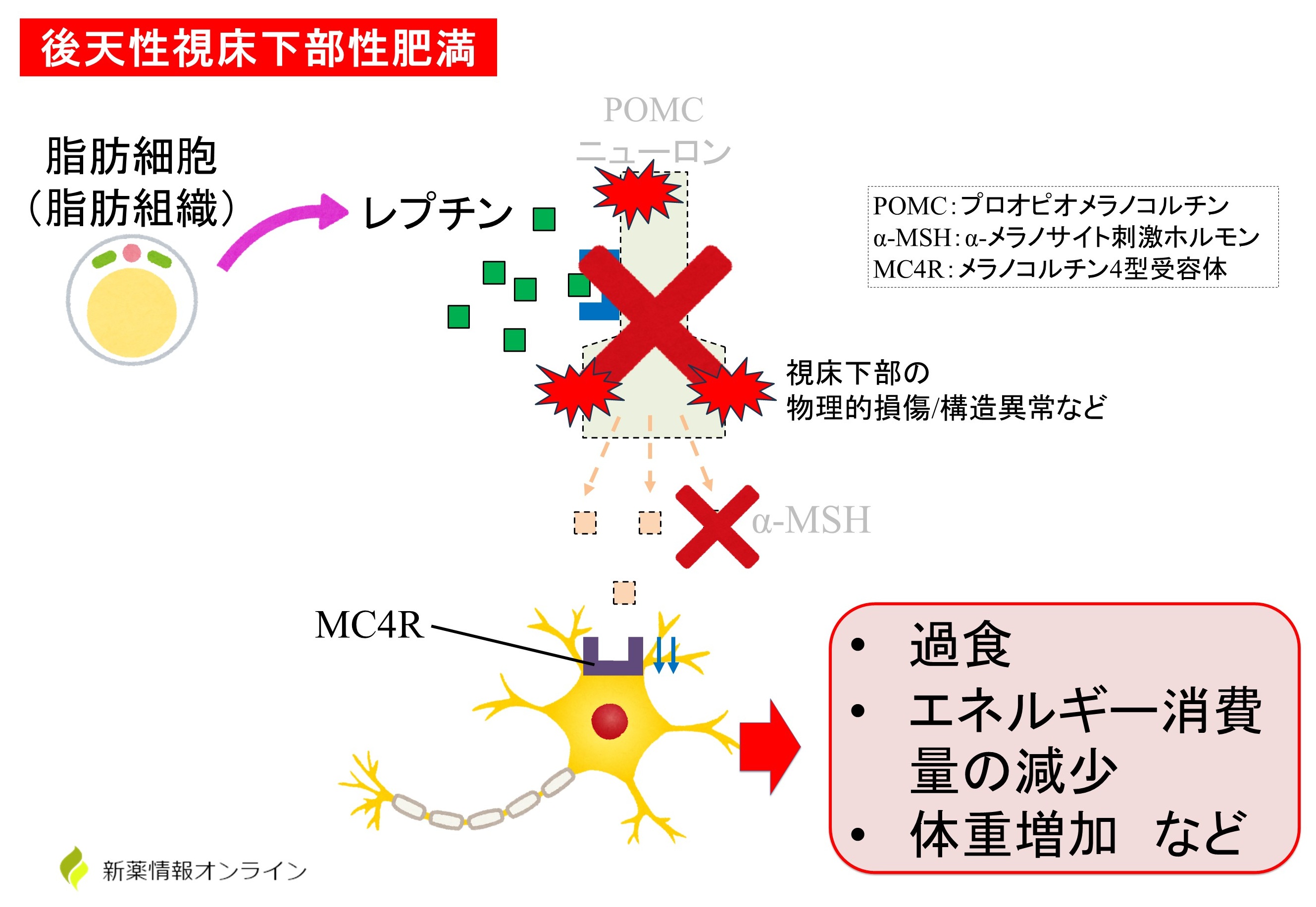 後天性視床下部性肥満ではα-MSHが分泌されなくなる